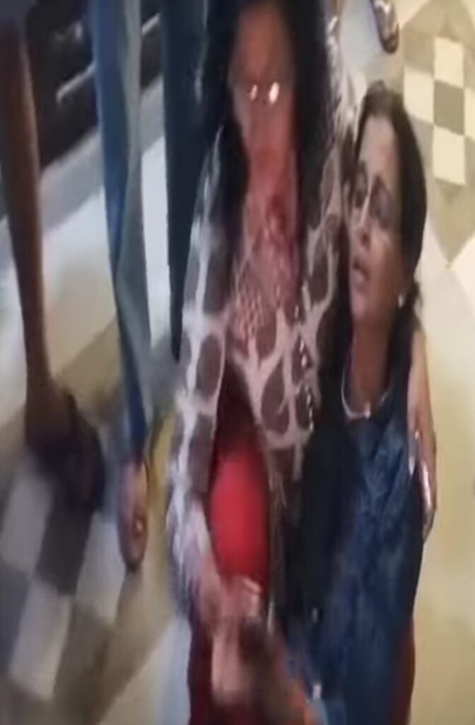 Horror in High-Rise: Woman Suffers After Being Trapped in Lift